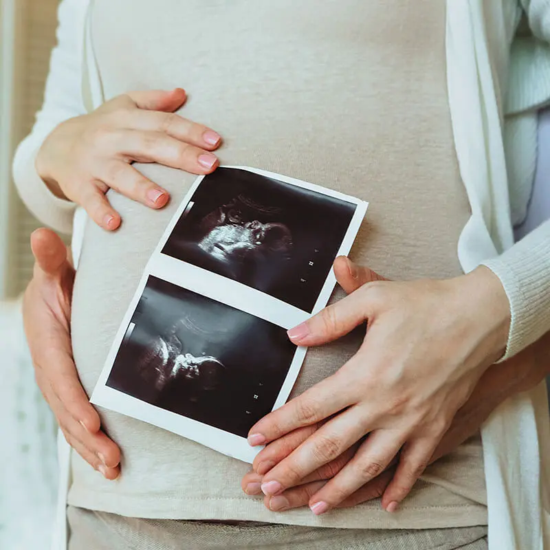 couple holding image of a baby