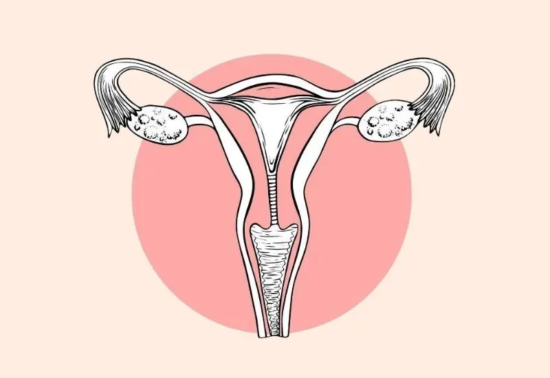 Ellsworth Plastic Surgery Ovarian hyperstimulation syndrome – Causes & risk factors