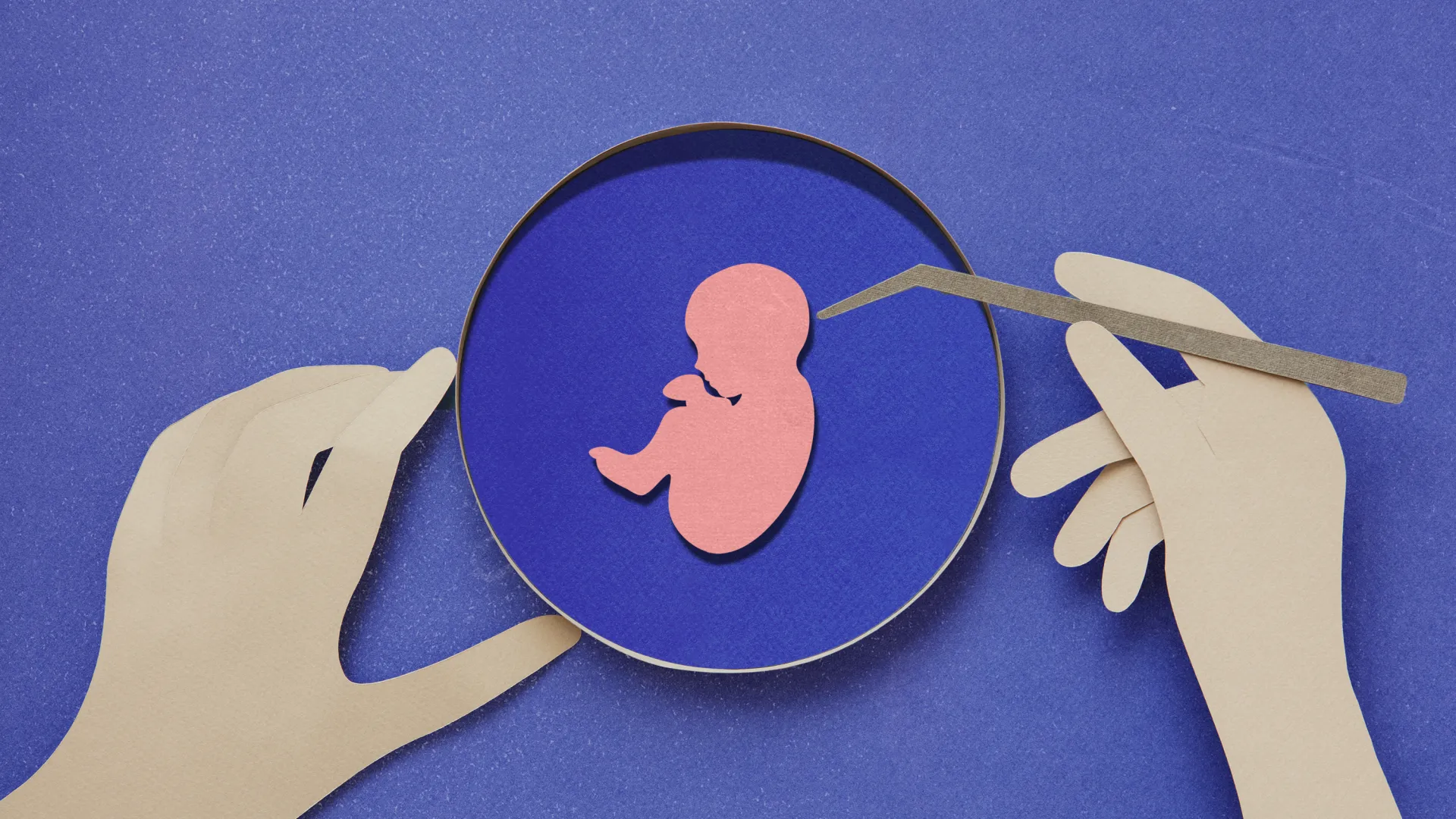 Exploring Faith-Based Views on Fertility Treatments - Image