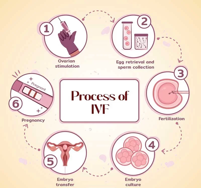 Fertility Treatment Timeline: IVF Process Stages & Tips - Image