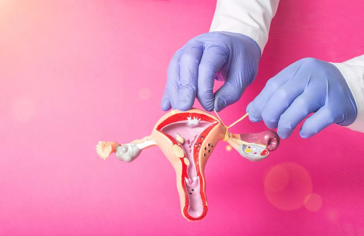 What Are My Options for Pregnancy After Tubal Ligation? - Image