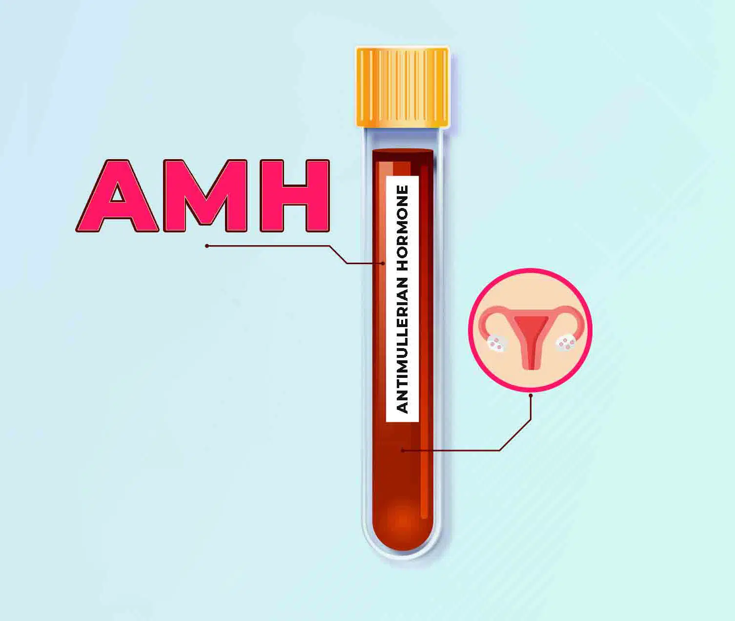 Understanding Anti-Müllerian Hormone (AMH) Levels and Fertility - Image